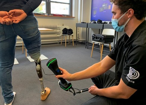 Scanning a prosthetic leg of a standing person with a 3D scanner