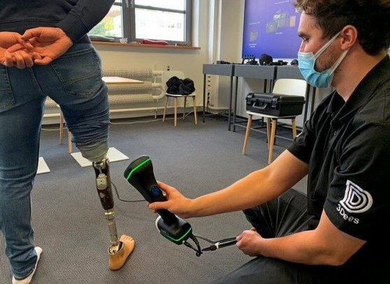 3D skener v ruce operátora snímá protézu pravé nohy stojící osoby